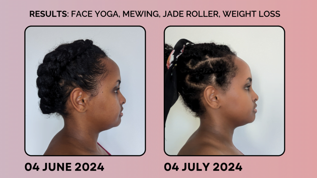 before and after 30 days of face yoga, mewing, and jade rolling, picture of black woman's side profile from June and July, jawline, neck